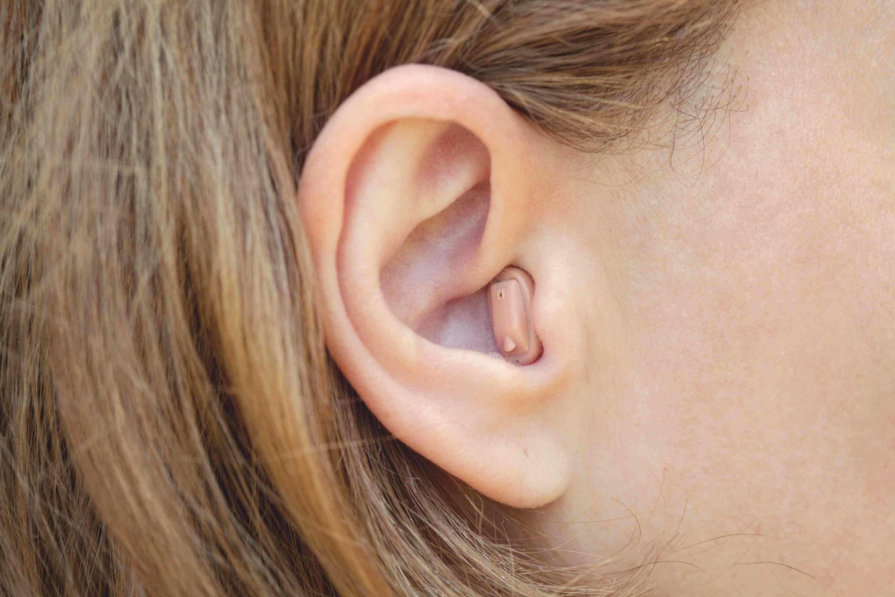 Completely in Canal Hearing Aid