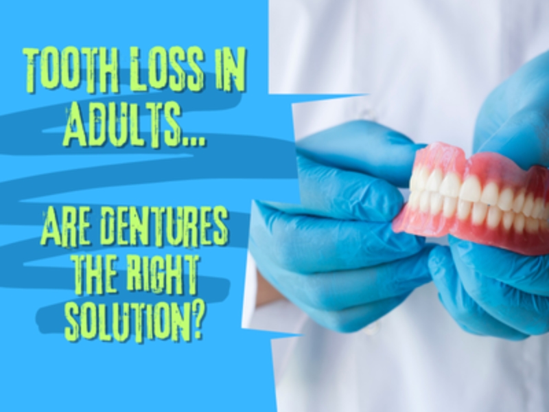 Tooth Loss in Adults: Dentures as a Solution